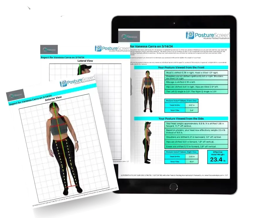 A personalized posture assessment online tool with descriptions of muscle imbalances